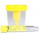 APOSAN ENVASE DE RECOGIDA DE ORINA 100 ML + TUBO DE ENSAYO