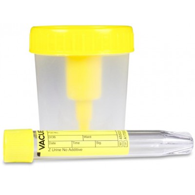 Comprar APOSAN ENVASE DE RECOGIDA DE ORINA 100 ML + TUBO DE ENSAYO al mejor precio en NuestraFarma, tu farmacia online